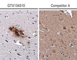 beta Amyloid (1-42) antibody – Conformation Specific_4