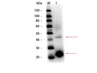 Anti-Acid Phosphatase antibody (HRP) used in Western Blot (WB). GTX41017