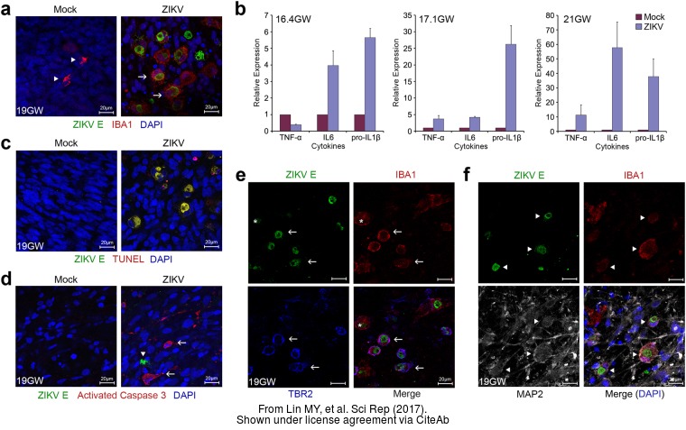 zika virus envelope protein antibody [gt363]