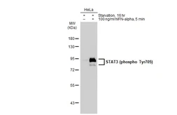 Anti-STAT3 (phospho Tyr705) antibody [GT1204] used in Western Blot (WB). GTX00966