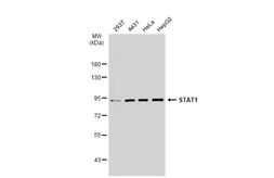Anti-STAT1 antibody [SD20-75] used in Western Blot (WB). GTX01142