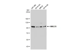 Anti-HMGCR antibody [GT1262] used in Western Blot (WB). GTX02859
