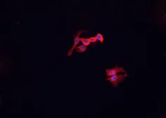 Anti-MSR1 antibody used in Immunocytochemistry/ Immunofluorescence (ICC/IF). GTX03371