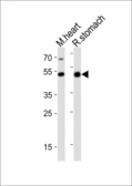 Anti-GATA6 antibody used in Western Blot (WB). GTX03398