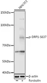 Anti-DRP1 (phospho Ser637) antibody used in Western Blot (WB). GTX03497