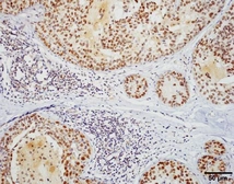 Anti-HSF1 antibody [10H8] used in IHC (Paraffin sections) (IHC-P). GTX04341