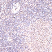 Anti-HSF1 antibody used in IHC (Paraffin sections) (IHC-P). GTX04342