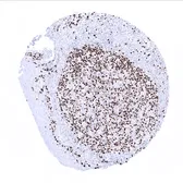 Anti-Ki67 antibody [MSVA-267M] HistoMAX&trade; used in IHC (Paraffin sections) (IHC-P). GTX04361