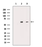 Anti-Estrogen Receptor beta (phospho Ser105) antibody used in Western Blot (WB). GTX04765