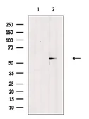 Anti-Estrogen Receptor beta (phospho Ser87) antibody used in Western Blot (WB). GTX04766