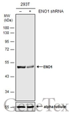 Anti-ENO1 antibody [N3C3] used in Western Blot (WB). GTX101803