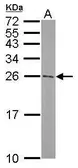 Anti-ATG5 antibody [N1C3] used in Western Blot (WB). GTX102361