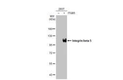 Anti-Integrin beta 5 antibody [N1C1] used in Western Blot (WB). GTX102680