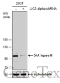 Anti-DNA ligase III antibody [C2C3], C-term used in Western Blot (WB). GTX103197