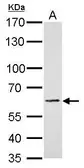 Anti-PAK1 antibody used in Western Blot (WB). GTX103797