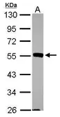 Anti-JNK2 antibody [N1C3] used in Western Blot (WB). GTX105523
