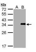 Anti-LASP1 antibody [N1N2], N-term used in Western Blot (WB). GTX108014