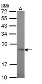 Anti-GADD45G antibody [C1C3] used in Western Blot (WB). GTX108257