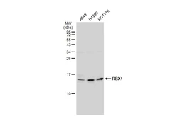 Anti-RBX1 antibody used in Western Blot (WB). GTX110507