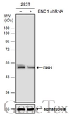 Anti-ENO1 antibody used in Western Blot (WB). GTX113179