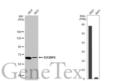 Anti-IGF2BP2 antibody used in Western Blot (WB). GTX113923