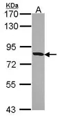 Anti-HSD17B4 antibody used in Western Blot (WB). GTX114978