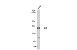 Anti-Gli1 antibody used in Western Blot (WB). GTX124274