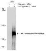 Anti-Her2 / ErbB2 (phospho Tyr1139) antibody used in Western Blot (WB). GTX130417