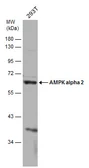 Anti-AMPK alpha 2 antibody used in Western Blot (WB). GTX132674