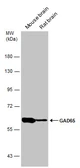 Anti-GAD65 antibody used in Western Blot (WB). GTX133156