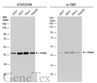 Anti-PAR4 antibody used in Western Blot (WB). GTX133766