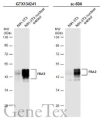 Anti-FRA2 antibody used in Western Blot (WB). GTX134241