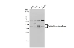 Anti-Folate Receptor alpha antibody used in Western Blot (WB). GTX134660