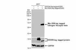 Anti-Estrogen Receptor beta antibody used in Western Blot (WB). GTX134663