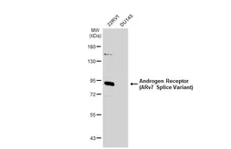 Anti-Androgen Receptor (ARv7 Splice Variant) antibody used in Western Blot (WB). GTX135345