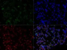 Anti-CXCR4 antibody used in Immunocytochemistry/ Immunofluorescence (ICC/IF). GTX13854