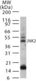 Anti-JNK2 antibody used in Western Blot (WB). GTX13871