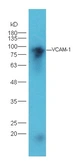 Anti-VCAM1 / CD106 antibody used in Western Blot (WB). GTX17547