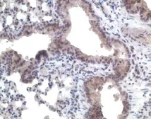 Anti-CCR11 antibody used in IHC (Paraffin sections) (IHC-P). GTX21660