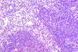 Anti-CCR8 antibody used in IHC (Paraffin sections) (IHC-P). GTX21663