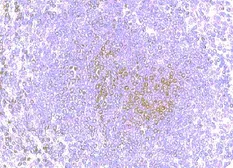 Anti-CCR8 antibody used in IHC (Paraffin sections) (IHC-P). GTX21665
