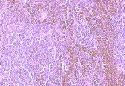 Anti-CCR8 antibody used in IHC (Paraffin sections) (IHC-P). GTX21666