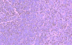 Anti-CCR5 antibody used in IHC (Paraffin sections) (IHC-P). GTX21673