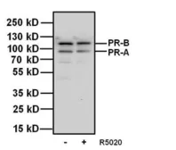 Anti-Progesterone Receptor antibody [Alpha PR6] used in Western Blot (WB). GTX22765