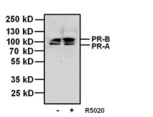 Anti-Progesterone Receptor antibody [alpha PR-22] used in Western Blot (WB). GTX22767