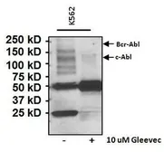 Anti-Phosphotyrosine antibody [IG2] used in Western Blot (WB). GTX25592