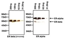 Anti-Estrogen Receptor beta antibody used in Western Blot (WB). GTX25786