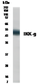 Anti-IKK gamma antibody used in Western Blot (WB). GTX30263