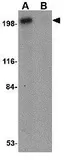 Anti-Integrin alpha 4 antibody used in Western Blot (WB). GTX31777