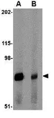 Anti-Integrin alpha 4 antibody used in Western Blot (WB). GTX31781